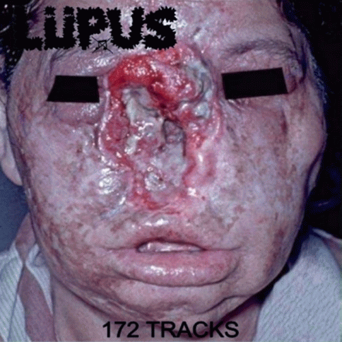 Lupus (BRA) : 172 Tracks